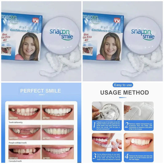 Premium Snap-On Smile – Natural Looking Teeth Instantly