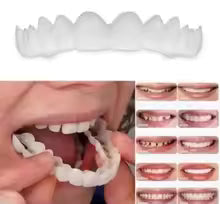 Premium Snap-On Smile – Natural Looking Teeth Instantly